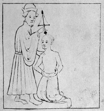 13th_century_trepanation._Wellcome_M0010165